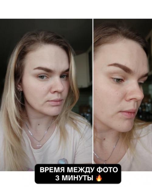 Откуда берутся носогубные складки, и как с ними бороться? 01 Откуда берутся носогубные складки, и как с ними бороться? 01