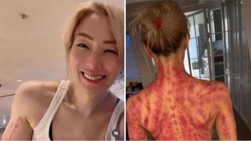 Певица сэмми чэн результат после массажа гуа ша показала. 02 Певица сэмми чэн результат после массажа гуа ша показала. 02