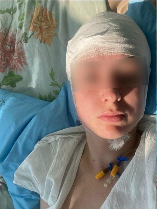 30-Летняя жительница твери перенесла инсульт во время близости с мужем. 01