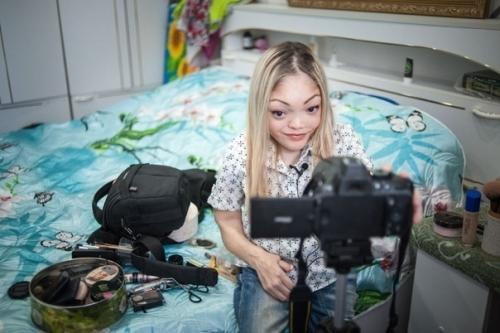 Лили Ло девушка с синдром олбрайта стала популярным бьюти - блоггером! 04