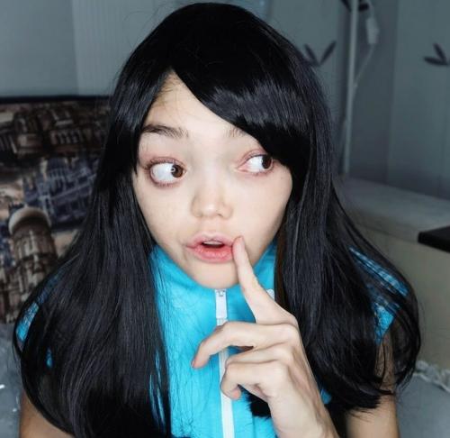 Лили Ло девушка с синдром олбрайта стала популярным бьюти - блоггером! 02