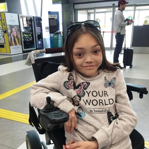 Лили Ло девушка с синдром олбрайта стала популярным бьюти - блоггером! 01