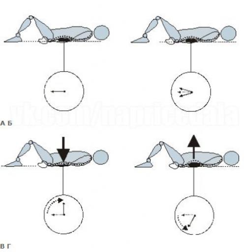 Остеохондроз: Жалеть или закачивать спину? 01 Остеохондроз: Жалеть или закачивать спину? 01