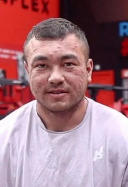 Бодибилдер продемонстрировал серьезный вред, нанесенный его телу стероидами. 02 Бодибилдер продемонстрировал серьезный вред, нанесенный его телу стероидами. 02