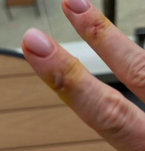 Эпизод 898.  Морской укус. 01