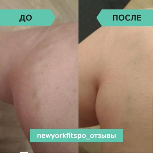 Фитнес - примета: если суставы ног теряют подвижность, появился дискомфорт, не за горами. 02