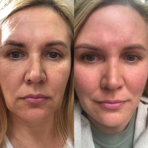 А когда будет результат? 01 А когда будет результат? 01