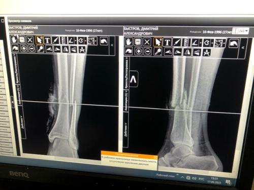 Здравствуйте, меня зовут Ирина и мне 23 года. 03 Здравствуйте, меня зовут Ирина и мне 23 года. 03