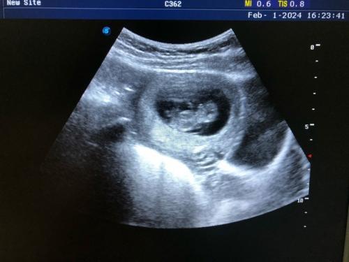 Здравствуйте, меня зовут Ирина и мне 23 года. 06 Здравствуйте, меня зовут Ирина и мне 23 года. 06