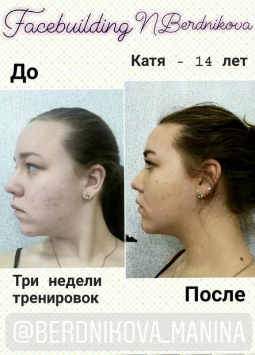 Сенсация. Гимнастика для лица самсебепластическийхирург гимназиявечноймолодостинбердниковой. 01 Сенсация. Гимнастика для лица самсебепластическийхирург гимназиявечноймолодостинбердниковой. 01