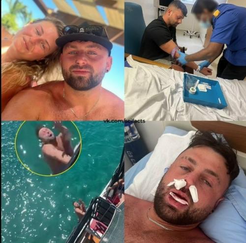 Турист из Великобритании прыгнул с яхты в море и разорвал губу.

