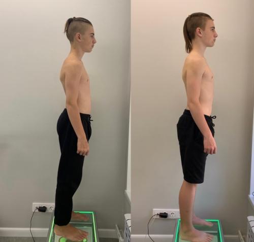 Невозможно улучшить осанку …. 01