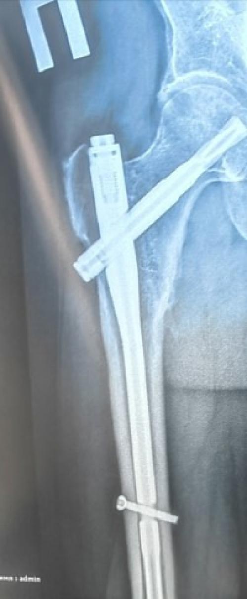 Моя история этого года. 02