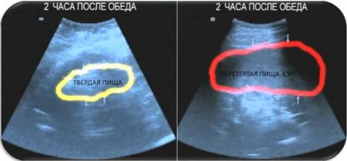 Как похудеть? 10. 03