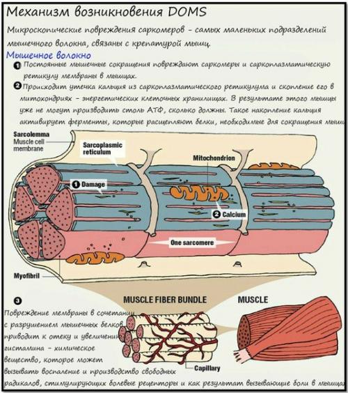 Крепатура мышц.  Кто виноват и что делать? 01 Крепатура мышц.  Кто виноват и что делать? 01