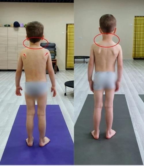 Занятия ЛФК для детей и взрослых теперь в центре Соликамска! 01