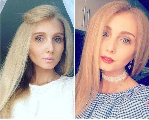Эта девушка смогла победить анорексию! 03