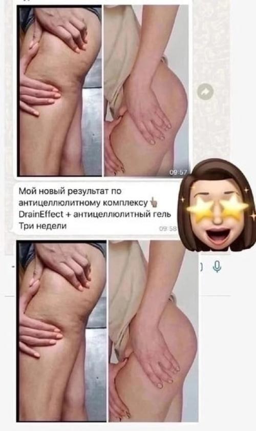 Действительно ли работает антицеллюлитный гель горипопа? 01