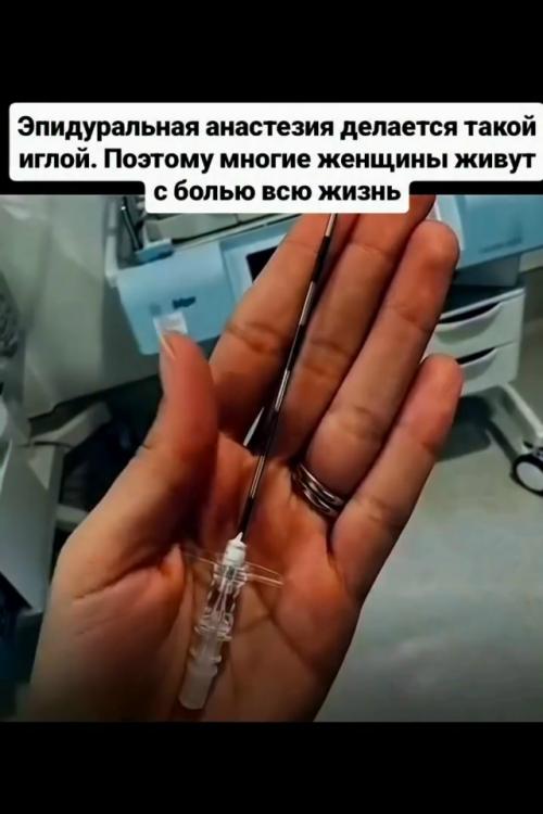 Игла для эпидуральной анестезии - большая, длинная, пугающая.  