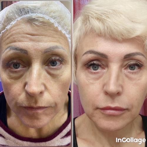 Сколько процедур мне надо? 01 Сколько процедур мне надо? 01