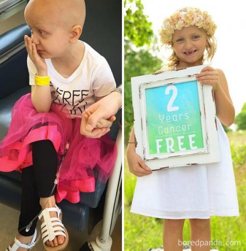 Лучшее до и после! 05