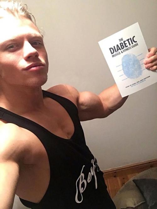 Эйдан броделл (Aidan Broddell) - фитнес - модель с диабетом первого типа! 02