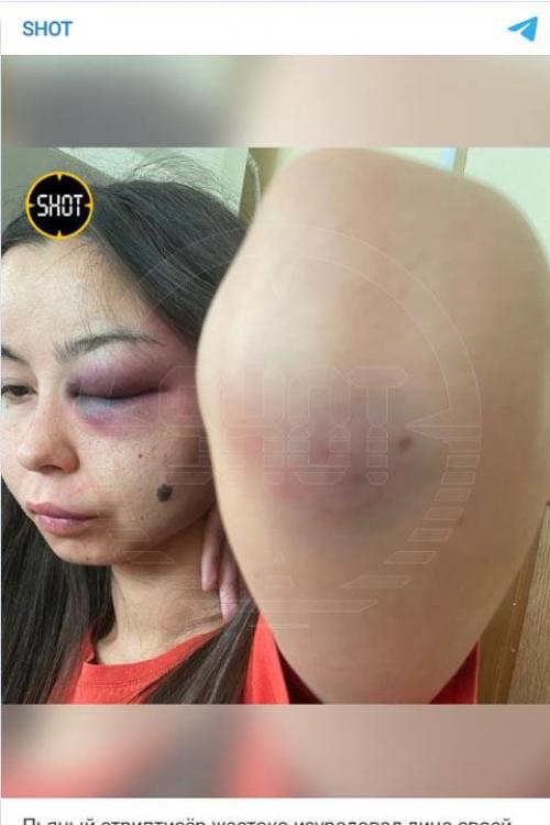 Абаканский стриптизер свою жену избил! 02 Абаканский стриптизер свою жену избил! 02