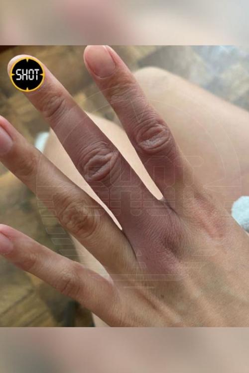 В Абакане стриптизер избил жену, подавшую на развод. 01 В Абакане стриптизер избил жену, подавшую на развод. 01