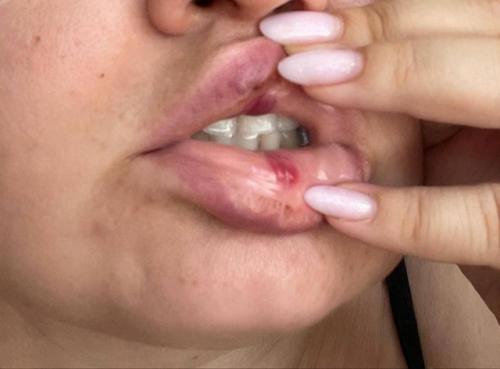 Эпизод 423.  Ночной инцидент. 02