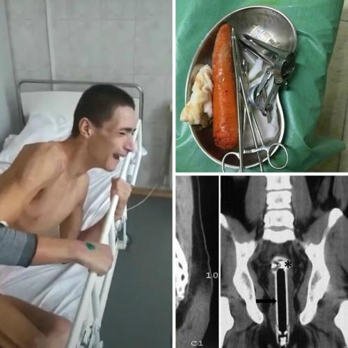 Кратко: 16-летнего подростка госпитализировали после того, как он получил травму от моркови.  