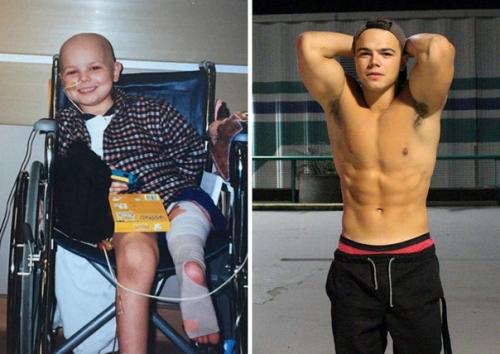 Вот это самая лучшая подборка фото до/после! 04