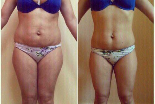 Мы объявляем набор в 6-й по счету проект мое идеальное тело? 02 Мы объявляем набор в 6-й по счету проект мое идеальное тело? 02