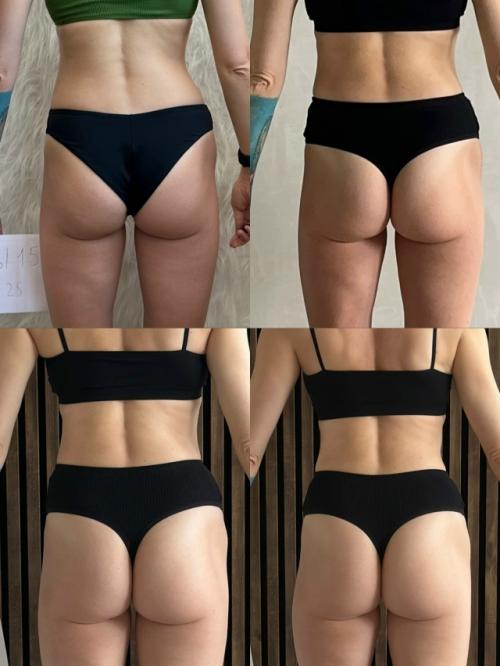 Я периодически пытаюсь вас мотивировать на занятия - осанкой, ходьбой, бегом, дыханием любой физической активностью. 03