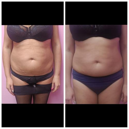 Как вам до/после. 01