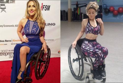 17 лет назад эта девушка попала в аварию и получила травму позвоночника. 05