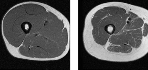 Зачем нужны силовые тренировки женщине 35-40 лет и старше? 01 Зачем нужны силовые тренировки женщине 35-40 лет и старше? 01