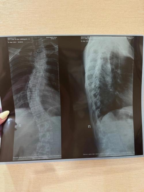 Наболевшая тема - боли в спине, сколиоз, остеохондроз? 01 Наболевшая тема - боли в спине, сколиоз, остеохондроз? 01