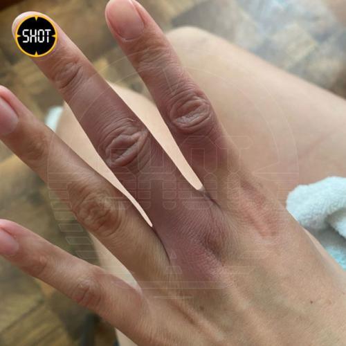 Пьяный стpиптизeр жeстоко изуродовал лицо своей жены в Республике Xакaсия. 03