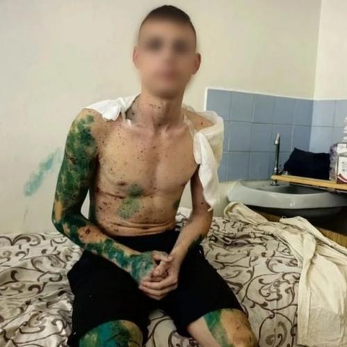 17-Летний студент старобельского колледжа Максим рассказал, как ему удалось выжить во время атаки на общежитие. 

