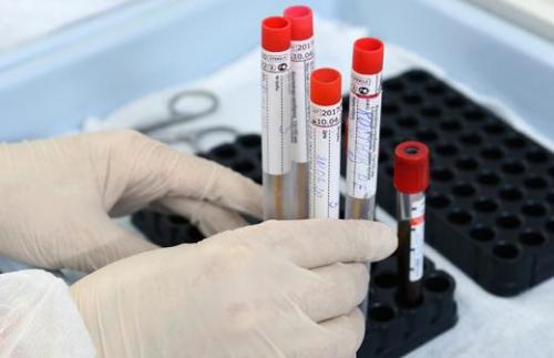 Лекарство от коронавируса 2020 найдено в России » Fozo.INFO. Вирусологи обнаружили блокирующий коронавирус препарат 01 Лекарство от коронавируса 2020 найдено в России » Fozo.INFO. Вирусологи обнаружили блокирующий коронавирус препарат 01