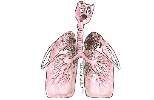 Можно ли вылечиться от туберкулеза полностью. Диагностика и подходы к лечению