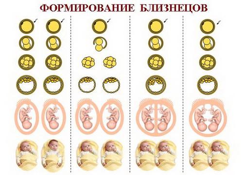 Естественные роды двойни. Естественные роды или кесарево?