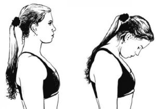 Зарядка для позвоночника шейного отдела. Значение занятий