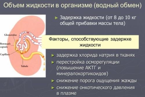 Причины задержки жидкости в организме. Причины задержки воды в организме: почему появляется отечность