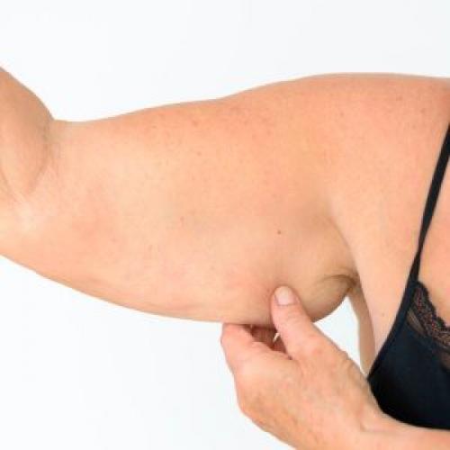 Обвисшая кожа на руках. Дряблость кожи рук