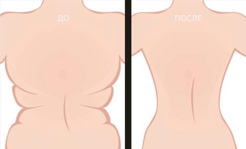 Как убрать жир со спины мужчине. Убираем складки и жир со спины в домашних условиях за короткий срок: диета и упражнения