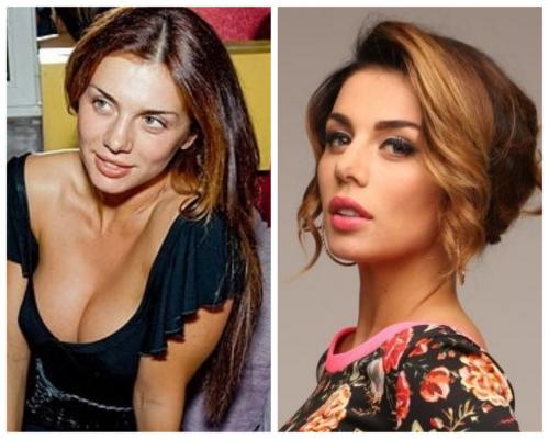 Ольга бузова до пластики. До и после пластики: Шейк, Боня, Хилькевич, Бузова, Брежнева и другие