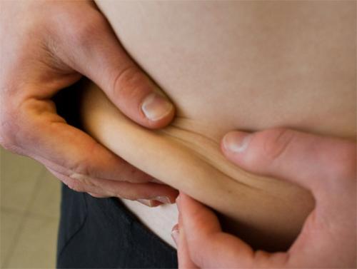 К чему приводит малоподвижный образ жизни 01