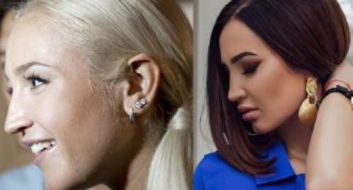 Ольга Бузова до пластики. Ольга Бузова до и после пластики