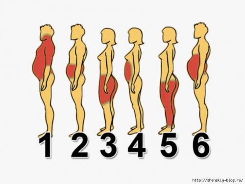 6 типов ожирения, как справиться с каждым из них. 6 видов ожирения и как с каждым из них бороться